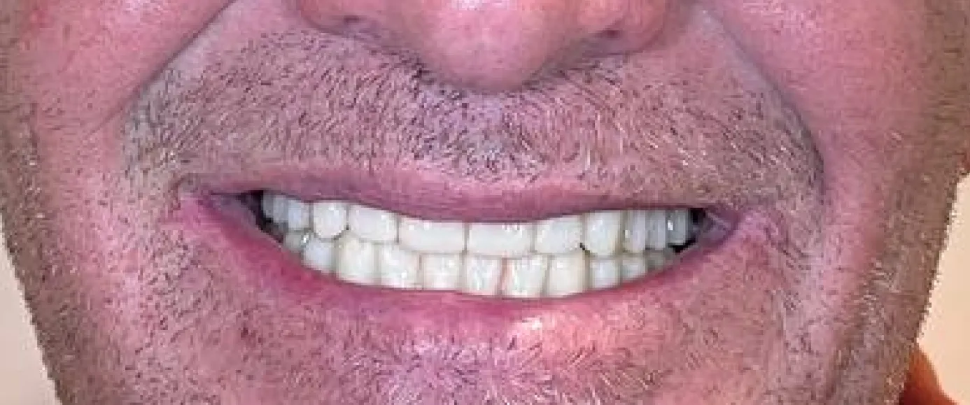 After view of dental treatment by Dr. Desmond Ng