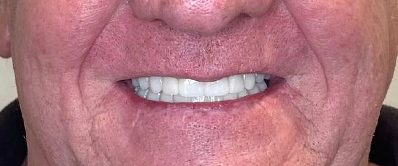 After view of dental treatment by Dr. Desmond Ng