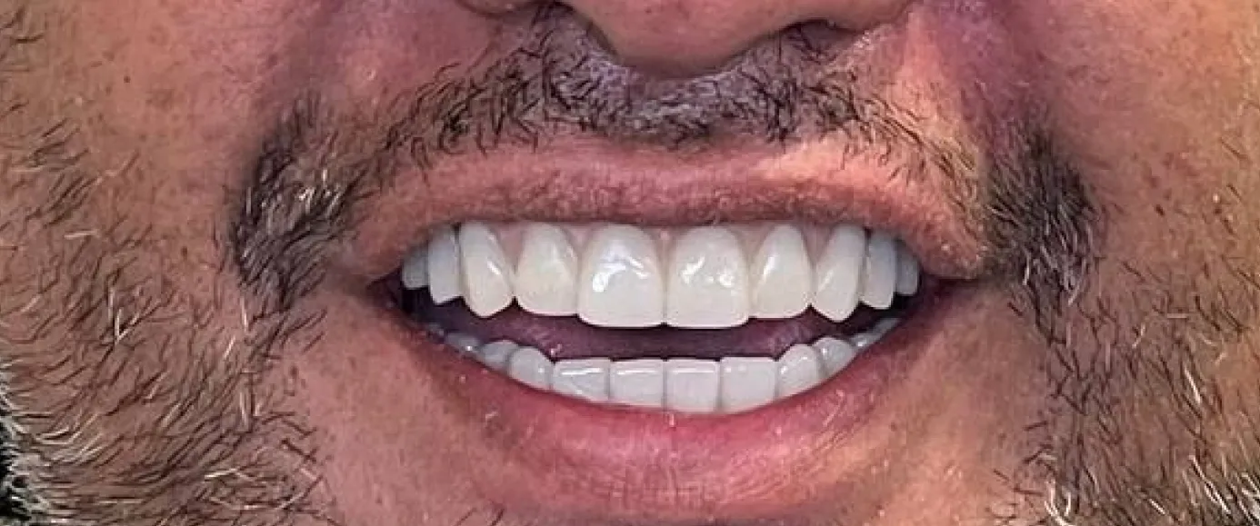 After view of dental treatment by Dr. Desmond Ng